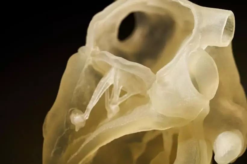 3D打印技术制作出非常逼真的透明和彩色患者肾脏模型