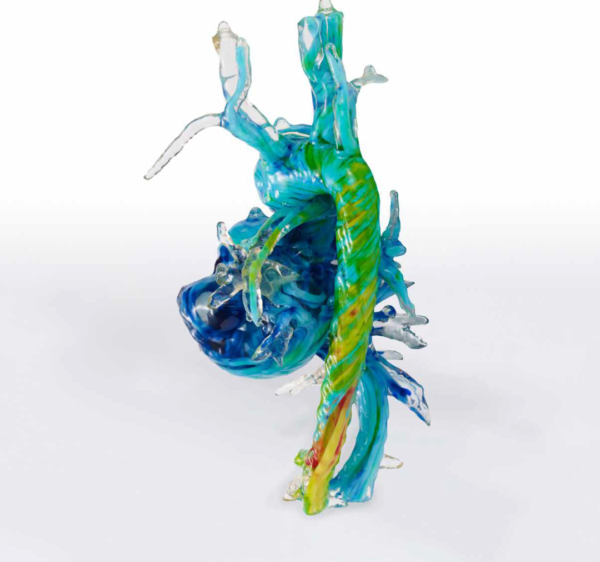 3D打印心脏模型