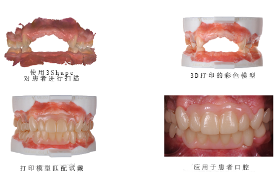 3D打印技术