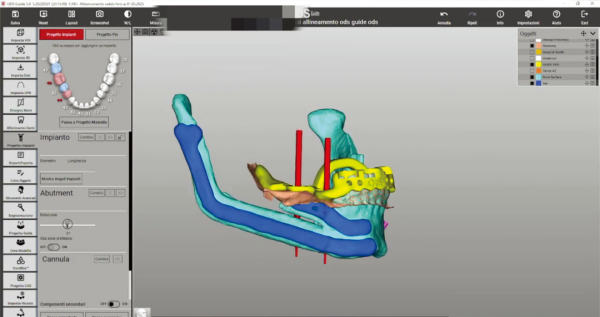 Stratasys DentaJet 3D打印机