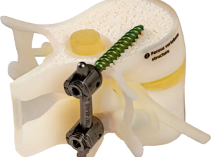 Bonematrix1