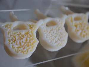 Bonematrix4