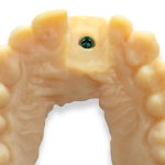 MED625FLX_1
