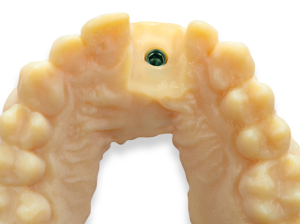MED625FLX_1