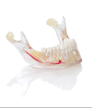 VeroDent™ PureWhite DEN847™
